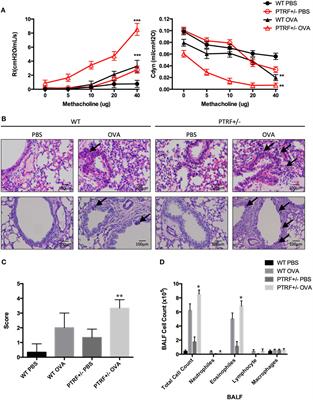 Dephosphorylated Polymerase I and Transcript Release Factor Prevents Allergic Asthma Exacerbations by Limiting IL-33 Release